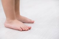Definition and Causes of Flat Feet in Children